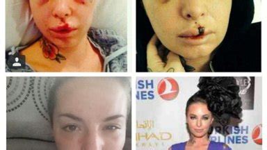 christy mack instagram|Photos: Christy Mack Documents Her Recovery After。